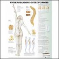 Osteoporosis Anatomical Poster