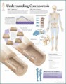 Osteoporosis Anatomy Poster