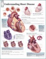 Understanding Heart Disease Anatomy Poster